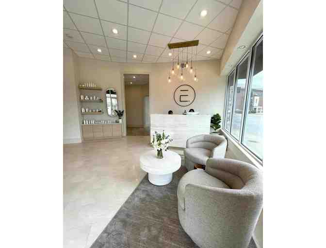 Full Face Dysport Treatment