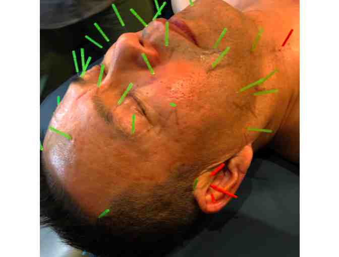 Facial Rejuvenation by Internal Alchemy