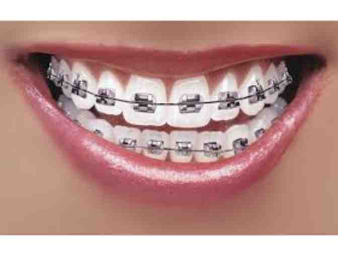 Barkate Othrodontics - $300 Gift Certificate towards Invisalign or Braces