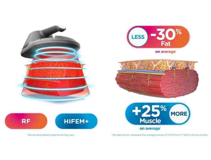 Emsculpt Fat burning + muscle building treatment + $100 off additional treatment