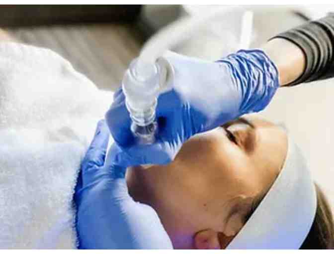 One Hydrafacial Platinum by SkinQ Facials & Waxing