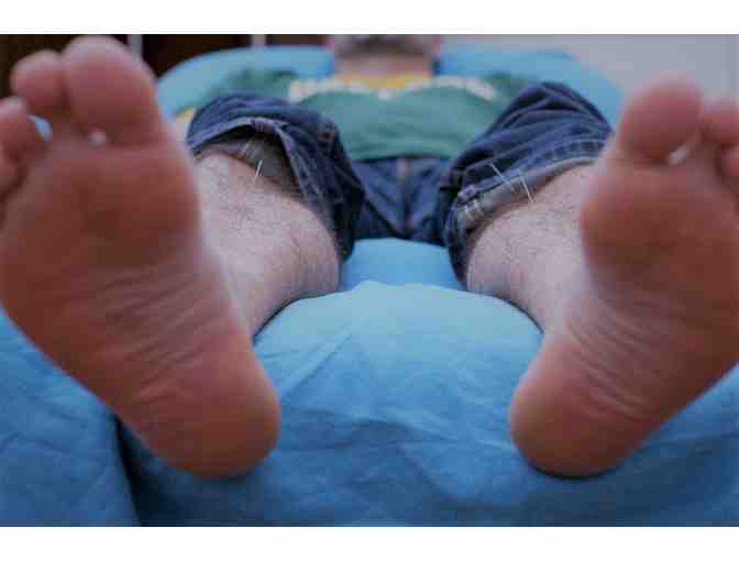 Initial Consultation and Acupuncture + follow-up acupuncture treatment