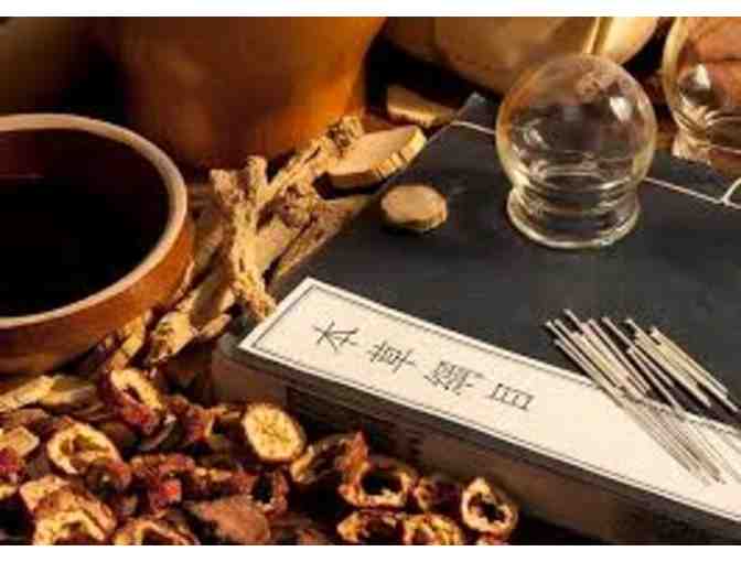 One Hour Acupuncture Treatment with Dr. James Fialk, Sebastopol CA