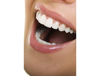 Whiter Teeth with Zoom 1 Hour Whitening at San Ramon Family Dental