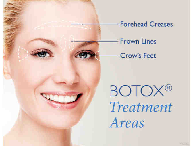 Botox Treatment from The Skin Clinics