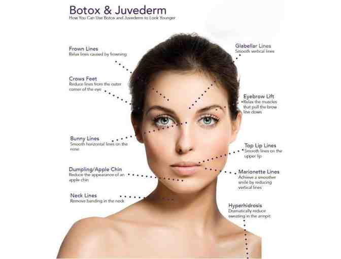 Botox!