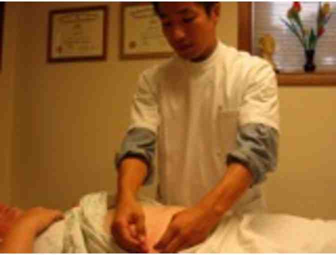 ACUPUNCTURE - 4 sessions - Traditional Eastern Medicine