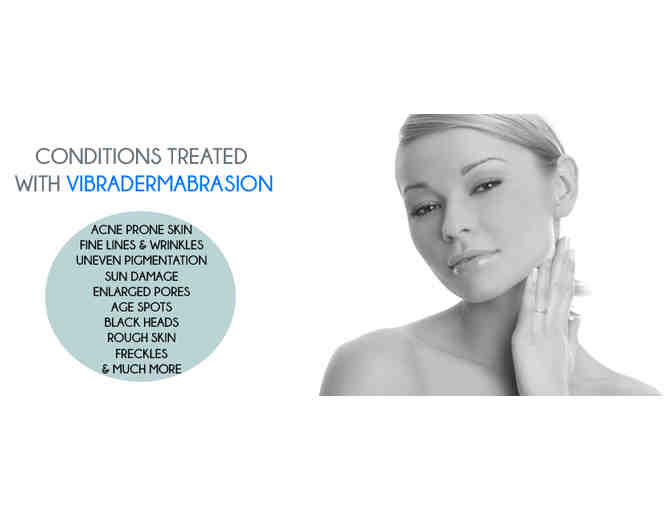 Facial Microdermabrasion (Vibraderm) - 3 Treatments