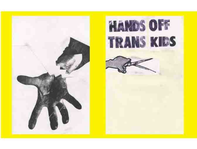 Hands Off Trans Kids
