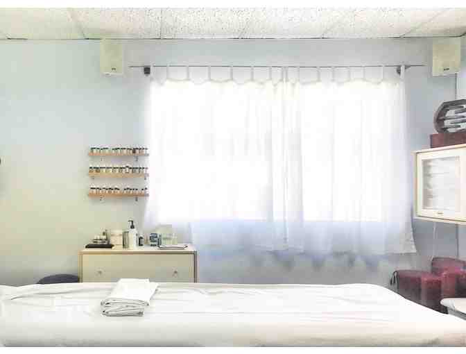 Acupuncture can help Acne, Anxiety, Asthma, Hormones, etc. (Valley Village)