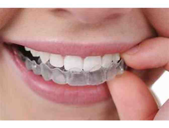 UPPER AND LOWER CLEAR ORTHODONTIC RETAINERS INVISALIGN