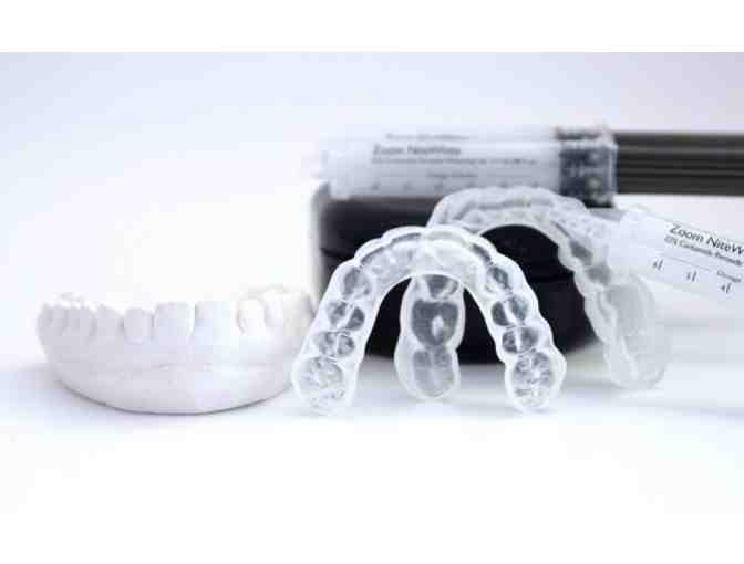 Star Ranch Dental Spa - $340 Custom Whitening Trays