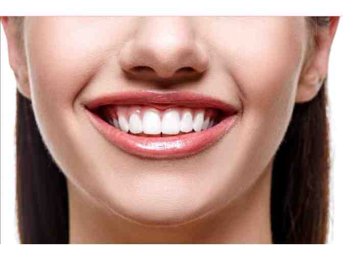 $950 Professional Teeth Whitening Experience + Luma Luxe Booster Kit for At-Home Use