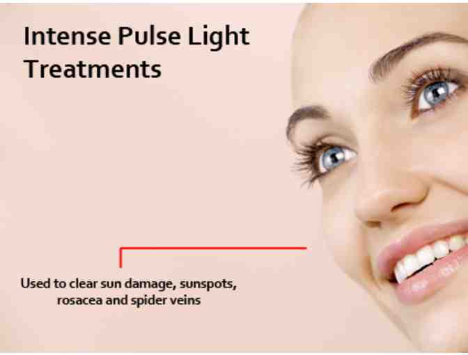 Micro-Needling Session by Belmont Plastic Surgery