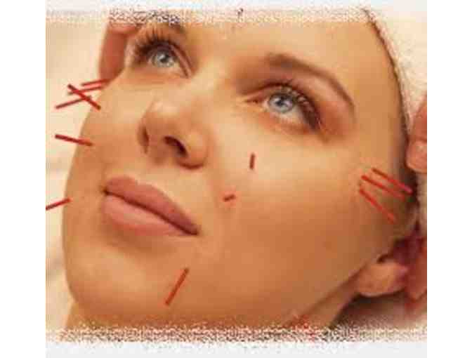 Mulberry Leaf De-Stress Acupuncture Treatment