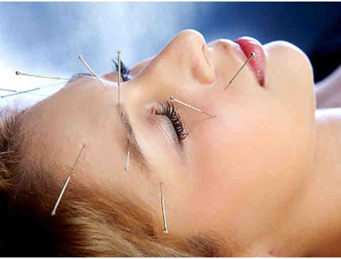 Acupuncture Treatment and Exam by Valerie Ducos