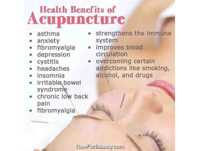 Acupuncture Treatment and Exam by Valerie Ducos