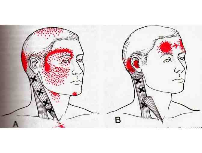 Migraine Cycle Relief Program