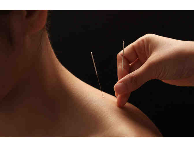 One Facial Rejuvenation Treatment with Acupuncture Continuum