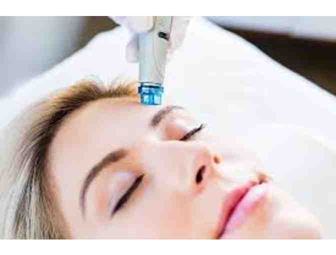 50% Off of Allure Skin Health Services up to $500