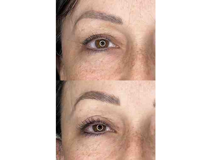 Jet Plasma or Plasma Fibroblast Skin Treatments at Volta Plasma Studio