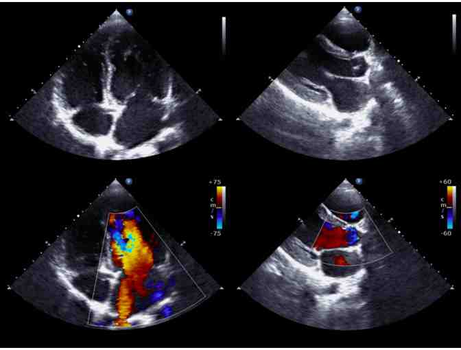 West Coast Ultrasound Institute - Preventive Health Screening