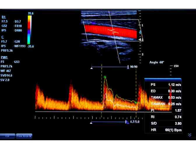 West Coast Ultrasound Institute - Preventive Health Screening